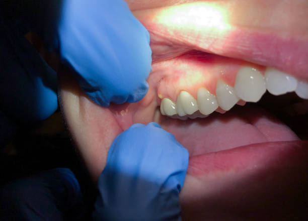 Best Pediatric Emergency Dentist in Valley Hill, NC